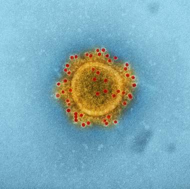 Los casos de coronavirus de Michigan (COVID-19) continúan aumentando, el estado total ahora es 787