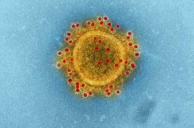 Los casos de coronavirus de Michigan (COVID-19) continúan aumentando, el estado total ahora es 787